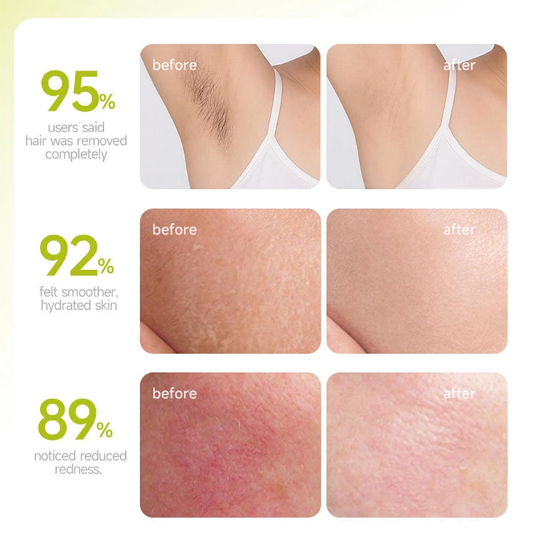 Permanent Hair Removal Cream